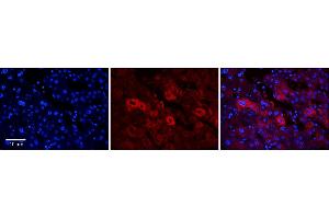 Rabbit Anti-EEA1 Antibody      Formalin Fixed Paraffin Embedded Tissue: Human Adult Liver   Observed Staining: Cytoplasm in hepatocytes, moderate signal, moderate tissue distribution  Primary Antibody Concentration: 1:100  Secondary Antibody: Donkey anti-Rabbit-Cy3  Secondary Antibody Concentration: 1:200  Magnification: 20X  Exposure Time: 0. (EEA1 antibody  (N-Term))
