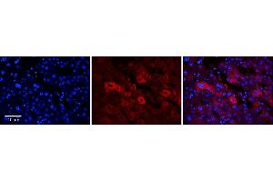 Rabbit Anti-EEA1 Antibody      Formalin Fixed Paraffin Embedded Tissue: Human Adult Liver   Observed Staining: Cytoplasm in hepatocytes, moderate signal, moderate tissue distribution  Primary Antibody Concentration: 1:100  Secondary Antibody: Donkey anti-Rabbit-Cy3  Secondary Antibody Concentration: 1:200  Magnification: 20X  Exposure Time: 0. (EEA1 antibody  (N-Term))