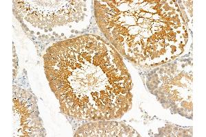 ABIN7094854 and ABIN7098905 at 1/100 staining Rat testis tissue by IHC-P. (PRRG4 antibody  (Internal Region))