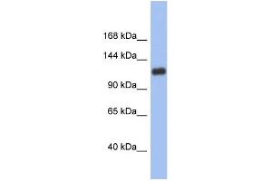 Western Blotting (WB) image for anti-Hypoxia Inducible Factor 1, alpha Subunit (Basic Helix-Loop-Helix Transcription Factor) (HIF1A) (Middle Region) antibody (ABIN2780373)