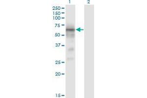 Western Blot analysis of BACE1 expression in transfected 293T cell line by BACE1 monoclonal antibody (M01), clone 2C1.