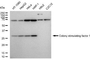Western blotting analysis using Colony stimulating factor 1 antibody (ABIN7798130).