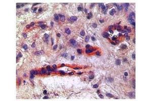 KDR in endothelial cells of blood vessels in placenta was detected using KDR antibody at a dilution of 5-10 ug/ml and stained with HRP/AEC red color stain. (VEGFR2/CD309 antibody  (N-Term))