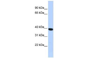 Western Blotting (WB) image for anti-Hyaluronidase-1 (HYAL1) antibody (ABIN2459449)