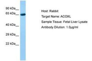 Image no. 1 for anti-Acyl-CoA Oxidase-Like (ACOXL) (AA 361-410) antibody (ABIN6750231) (ACOXL antibody  (AA 361-410))