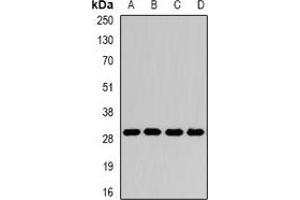 Western blot analysis of GAMT expression in Jurkat (A), Hela (B), mouse liver (C), rat brain (D) whole cell lysates. (GAMT antibody)