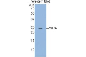 Detection of Recombinant LAMa2, Mouse using Polyclonal Antibody to Laminin Alpha 2 (LAMa2) (Laminin antibody  (AA 2901-3106))