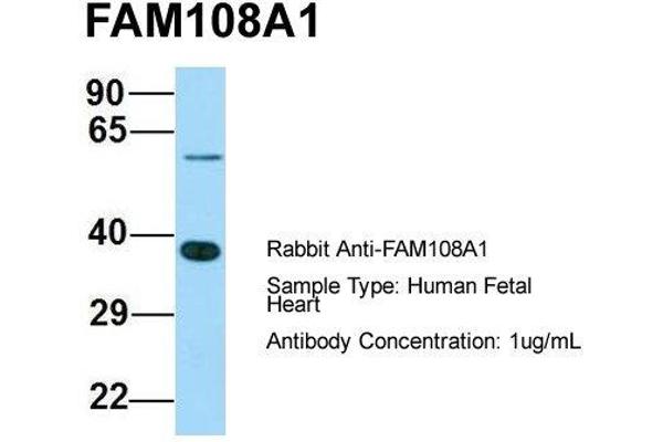 ABHD17A antibody  (C-Term)