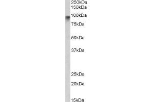 ABIN2564110 (2µg/ml) staining of Human Pancrease lysate (35µg protein in RIPA buffer). (Neuroligin 2 antibody  (Internal Region))