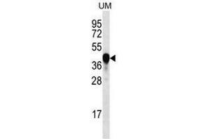PROX2 Antibody (C-term) western blot analysis in UM cell line lysates (35µg/lane).