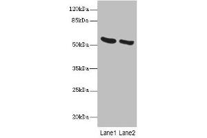 Western blot All lanes: PNPLA2 antibody at 10 μg/mL Lane 1: Mouse liver tissue Lane 2: NIH/3T3 whole cell lysate Secondary Goat polyclonal to rabbit IgG at 1/10000 dilution Predicted band size: 56, 20 kDa Observed band size: 56 kDa (PNPLA2 antibody  (AA 1-504))