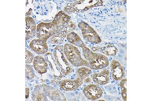 Immunohistochemistry (IHC) image for anti-Spectrin Repeat Containing, Nuclear Envelope 1 (SYNE1) antibody (ABIN7270520)