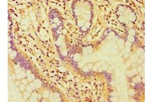 Immunohistochemistry of paraffin-embedded human small intestine tissue using ABIN7146954 at dilution of 1:100 (Caspase 6 antibody  (AA 24-293))