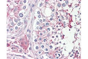 Anti-HRASLS antibody IHC of human testis. (HRASLS antibody  (AA 4-17))