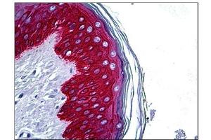 Human Skin: Formalin-Fixed, Paraffin-Embedded (FFPE) (KRT14 antibody  (C-Term))