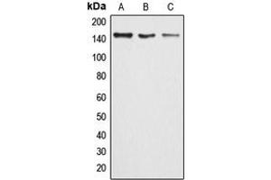 Western blot analysis of ARID4B expression in HeLa (A), MCF7 (B), rat lung (C) whole cell lysates. (BRCAA1 antibody  (Center))