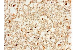 IHC image of ABIN7142087 diluted at 1:1000 and staining in paraffin-embedded human brain tissue performed on a Leica BondTM system. (YWHAE antibody  (AA 1-255))