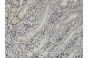 Image no. 1 for anti-Distal-Less Homeobox Protein 2 (DLX2) (AA 1-110) antibody (ABIN598648) (DLX2 antibody  (AA 1-110))