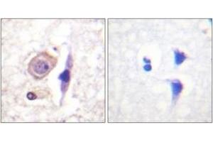 Immunohistochemistry analysis of paraffin-embedded human brain tissue, using Interferon-gamma Receptor alpha chain (Ab-457) Antibody. (IFNGR1 antibody  (AA 431-480))