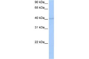 WB Suggested Anti-RBM4 Antibody Titration:  0. (RBM4 antibody  (C-Term))