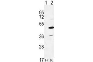 Western blot analysis of IRAK4 antibody and 293 cell lysate either nontransfected (Lane 1) or transiently transfected (2) with the IRAK4 gene. (IRAK4 antibody  (AA 5-36))
