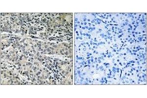 Immunohistochemistry analysis of paraffin-embedded human prostate carcinoma tissue, using MP68 Antibody. (C14orf2 antibody  (AA 9-58))