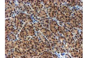 Image no. 6 for anti-NQO2 (NQO2) antibody (ABIN1499816)