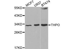 Western blot analysis of extracts of various cell lines, using THPO antibody. (Thrombopoietin antibody)