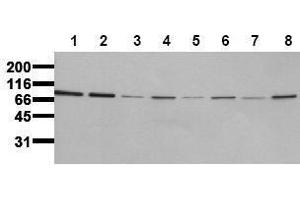 Western Blotting (WB) image for anti-Insulin Receptor (INSR) (Beta Chain) antibody (ABIN126821)
