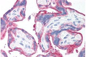 Human Placenta (formalin-fixed, paraffin-embedded) stained with CD59 antibody ABIN214204 at 20 ug/ml followed by biotinylated anti-mouse IgG secondary antibody ABIN481714, alkaline phosphatase-streptavidin and chromogen. (CD59 antibody)