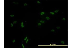 Immunofluorescence of monoclonal antibody to CCNL1 on HeLa cell. (Cyclin L1 antibody  (AA 1-172))