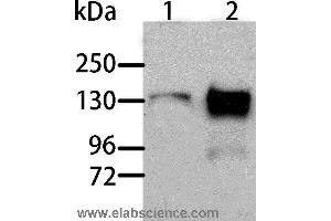 Western blot analysis of Human liver cancer and normal liver tissue, using AOX1 Polyclonal Antibody at dilution of 1:1000 (AOX1 antibody)