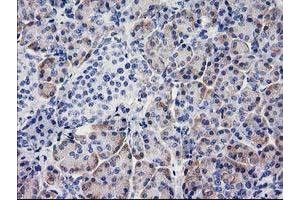 Immunohistochemistry (IHC) image for anti-Beclin 1, Autophagy Related (BECN1) antibody (ABIN1496865) (Beclin 1 antibody)