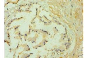 Immunohistochemistry of paraffin-embedded human prostate tissue using ABIN7157843 at dilution of 1:100 (GLO1 antibody  (AA 1-184))