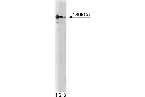 Western blot analysis of NMDAR2B on a rat cerebrum lysate. (GRIN2B antibody  (AA 892-1051))