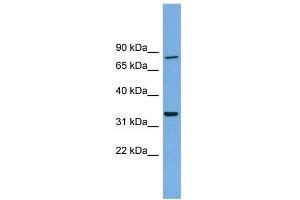 WB Suggested Anti-DDHD2 Antibody Titration: 0. (DDHD2 antibody  (N-Term))