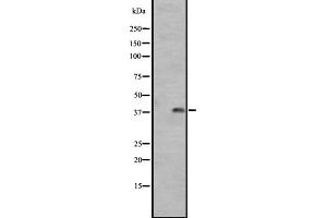 Western blot analysis of GPR1 expression in A431 whole cell lysate ,The lane on the left is treated with the antigen-specific peptide.
