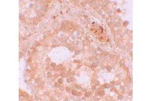 Immunohistochemical staining of human testis cells with WDR92 polyclonal antibody  at 10 ug/mL.