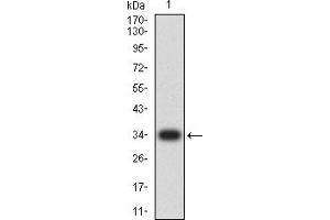 PMS2 antibody