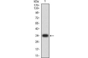 Western blot analysis using PMS2 mAb against human PMS2 (AA: 431-580) recombinant protein.