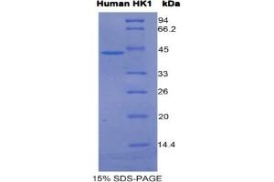 SDS-PAGE (SDS) image for Hexokinase 1 (HK1) ELISA Kit (ABIN6574201)