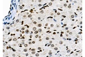 ABIN6263641 and ABIN6278983 at 1/100 staining Rat ovarian tissue by IHC-P. (NKAP antibody  (N-Term))