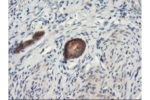 Image no. 2 for anti-Proteasome Subunit alpha 4 (PSMA4) antibody (ABIN1500457) (PSMA4 antibody)