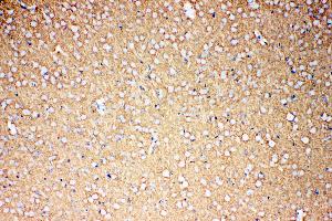 Anti-EAAT1 antibody, IHC(P) IHC(P): Rat Brain Tissue (SLC1A3 antibody  (C-Term))