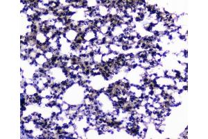 IHC analysis of CIC using anti-CIC antibody (ABIN6719536).