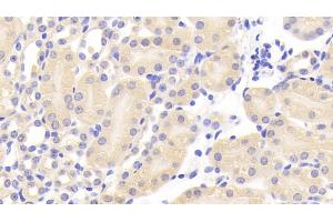 Detection of CEACAM1 in Mouse Kidney Tissue using Polyclonal Antibody to Carcinoembryonic Antigen Related Cell Adhesion Molecule 1 (CEACAM1) (CEACAM1 antibody  (AA 35-143))