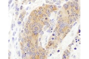 Immunohistochemistry (IHC) image for anti-Chaperonin Containing TCP1, Subunit 3 (Gamma) (CCT3) (AA 300-350) antibody (ABIN7453614) (CCT3 antibody  (AA 300-350))