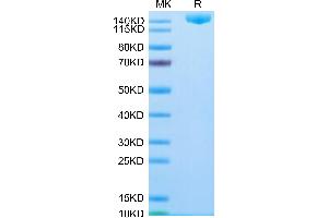 SARS-COV-2 Spike S (Omicron B. (SARS-CoV-2 Spike Protein (B.1.1.529 - Omicron, Trimer) (His tag))