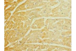 Immunohistochemistry of paraffin-embedded human heart tissue using ABIN7169925 at dilution of 1:100 (SCN7A antibody  (AA 265-368))