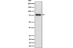 Western blot analysis of Cip4 expression in HepG2 cell lysate.